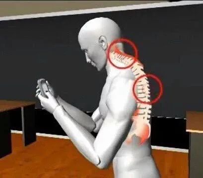 استشاري يكشف عن أسباب انحراف الفقرات لدى الأطفال.. ومتى يصبح التدخل الجراحي ضروريًا؟
