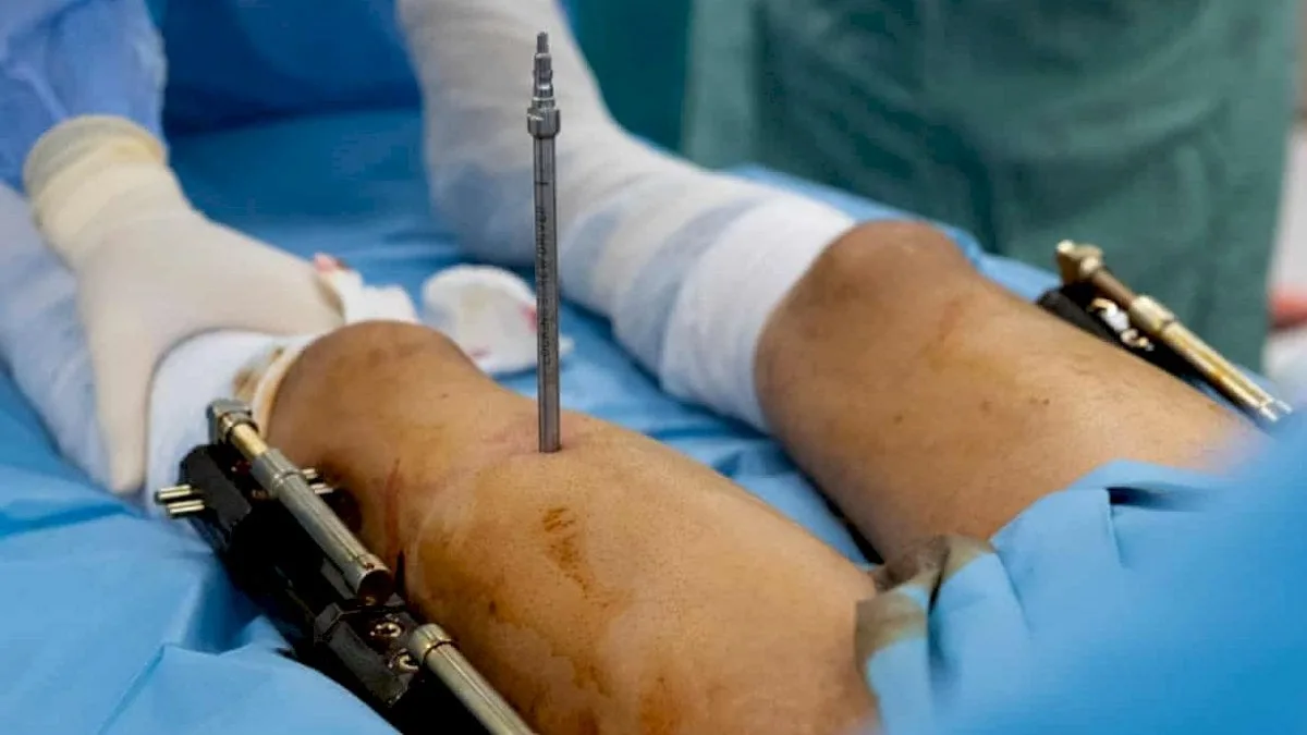 قصر القامة: معاناة الرجال وثروتهم من أجل إطالة الساقين