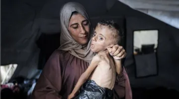 زيادة عدد شهداء المجاعة في غزة إلى 332، بينهم 124 طفلاً
