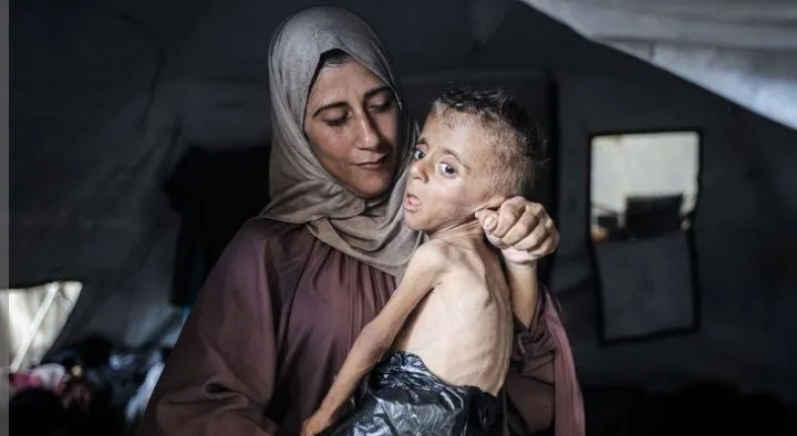 زيادة عدد شهداء المجاعة في غزة إلى 332، بينهم 124 طفلاً زيادة عدد شهداء المجاعة في غزة إلى 332، بينهم 124 طفلاً