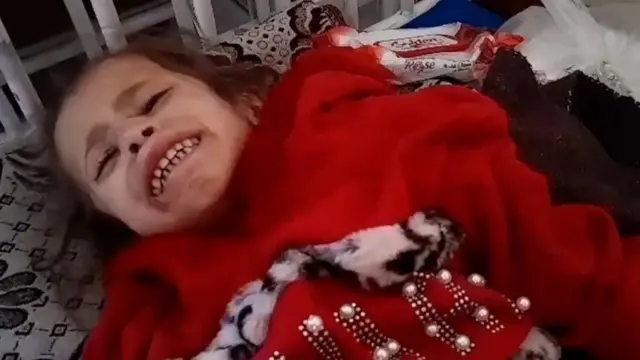 ارتفاع عدد ضحايا المجاعة إلى 197 شهيدًا بينهم 96 طفلًا