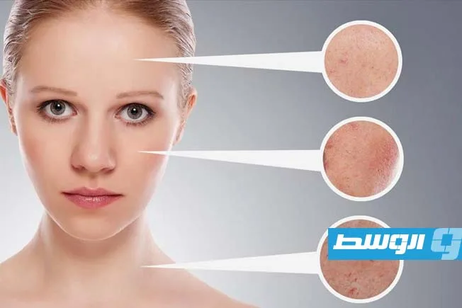 استخدام النشا وماء الورد لت uniformity لون البشرة استخدام النشا وماء الورد لت uniformity لون البشرة