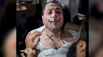 اعتداء على فنان سوري في العلن: تم قص شعره وكتابة عبارات على وجهه