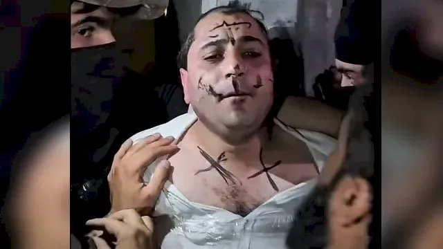 اعتداء على فنان سوري في العلن: تم قص شعره وكتابة عبارات على وجهه