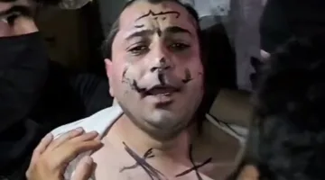 المرصد: تحت ضغط السلاح… إهانة مطرب شعبي وحلق شعره في ريف حلب الشمالي (فيديو)