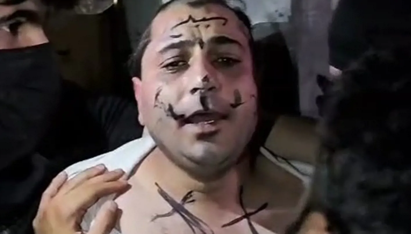 المرصد: تحت ضغط السلاح… إهانة مطرب شعبي وحلق شعره في ريف حلب الشمالي (فيديو) المرصد: تحت ضغط السلاح… إهانة مطرب شعبي وحلق شعره في ريف حلب الشمالي (فيديو)