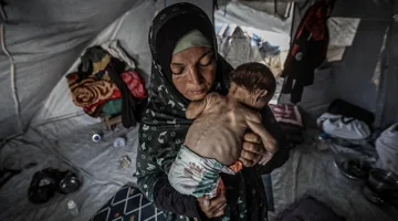 بسبب تلوث المياه ونقص التغذية، الشلل الرخو الحاد يزداد بين أطفال غزة