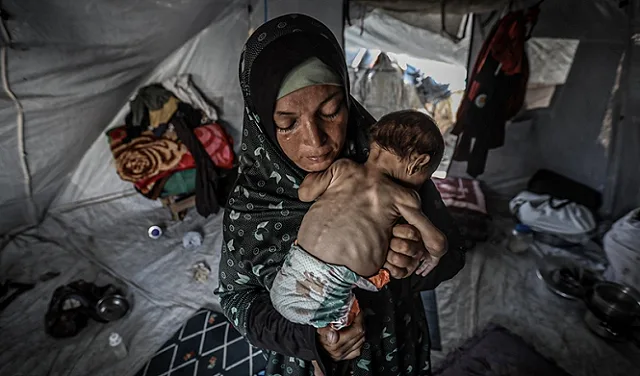 بسبب تلوث المياه ونقص التغذية، الشلل الرخو الحاد يزداد بين أطفال غزة بسبب تلوث المياه ونقص التغذية، الشلل الرخو الحاد يزداد بين أطفال غزة