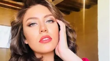 بعد تعرض رحمة حسن للإصابة.. أسباب غير متوقعة تؤدي إلى تساقط الشعر.