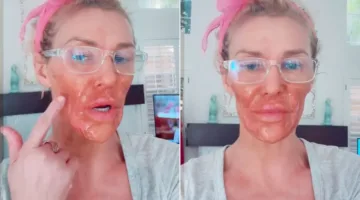 ‘خدعة تجميلية’ تتسبب في حروق لوجه نجمة تلفزيون الواقع (فيديو)