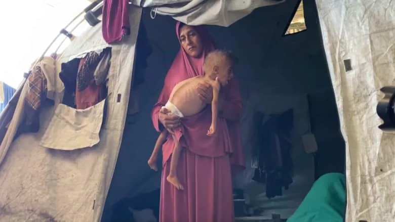 زيادة عدد ضحايا الجوع في غزة إلى 289 شخصًا