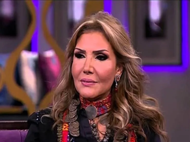 قبل إجراء عمليتها الجراحية، نادية مصطفى تساند أنغام برسالة مؤثرة.