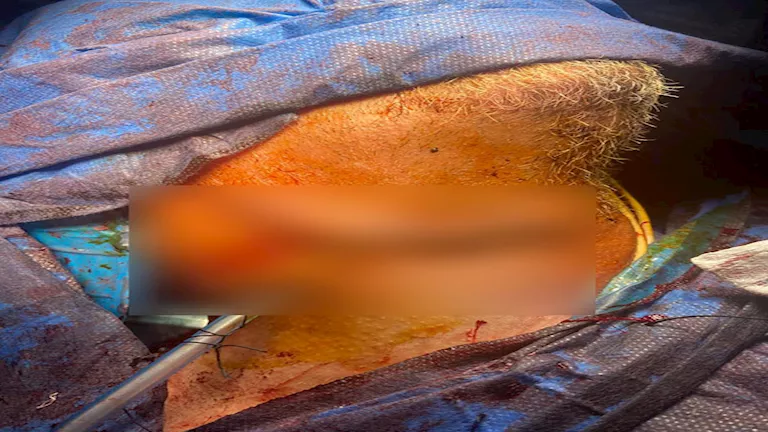 منشار كهربائي يصيب رجل في رقبته وجراحو جامعة أسيوط يتدخلون لإنقاذه – صور منشار كهربائي يصيب رجل في رقبته وجراحو جامعة أسيوط يتدخلون لإنقاذه – صور