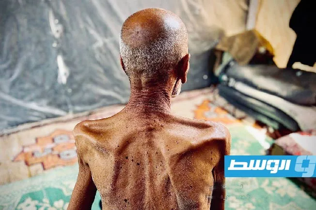 وزارة الصحة الفلسطينية: 180 شهيداً نتيجة المجاعة في غزة، من بينهم 93 طفلاً